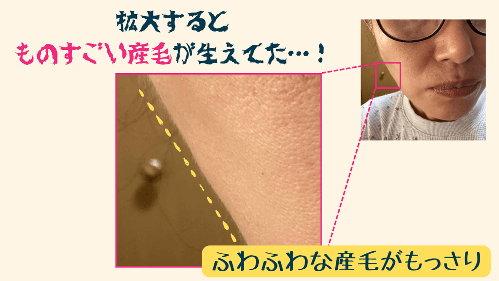 カメラで撮って拡大してみると、ものすごい量の産毛がもっさりと生えていた