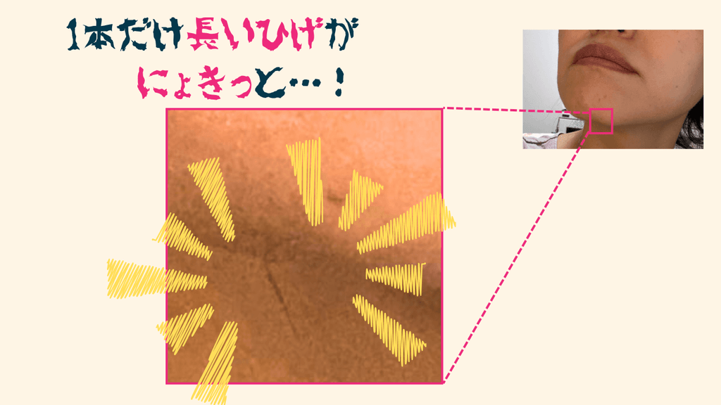 1本だけ長いひげがにょきっと生えていた